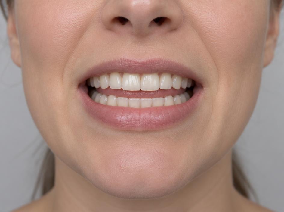 Real mouth position for s, with the tongue blade raised behind the teeth